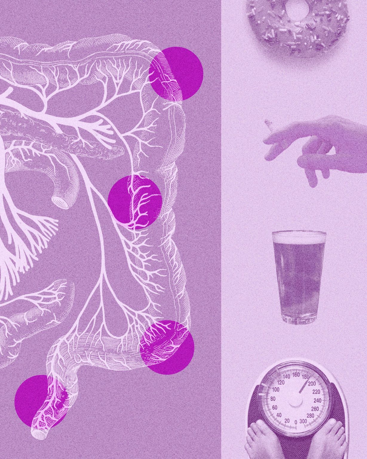 Nearly Half of Colorectal Cancers Now Occur in Younger Patients, Study ...